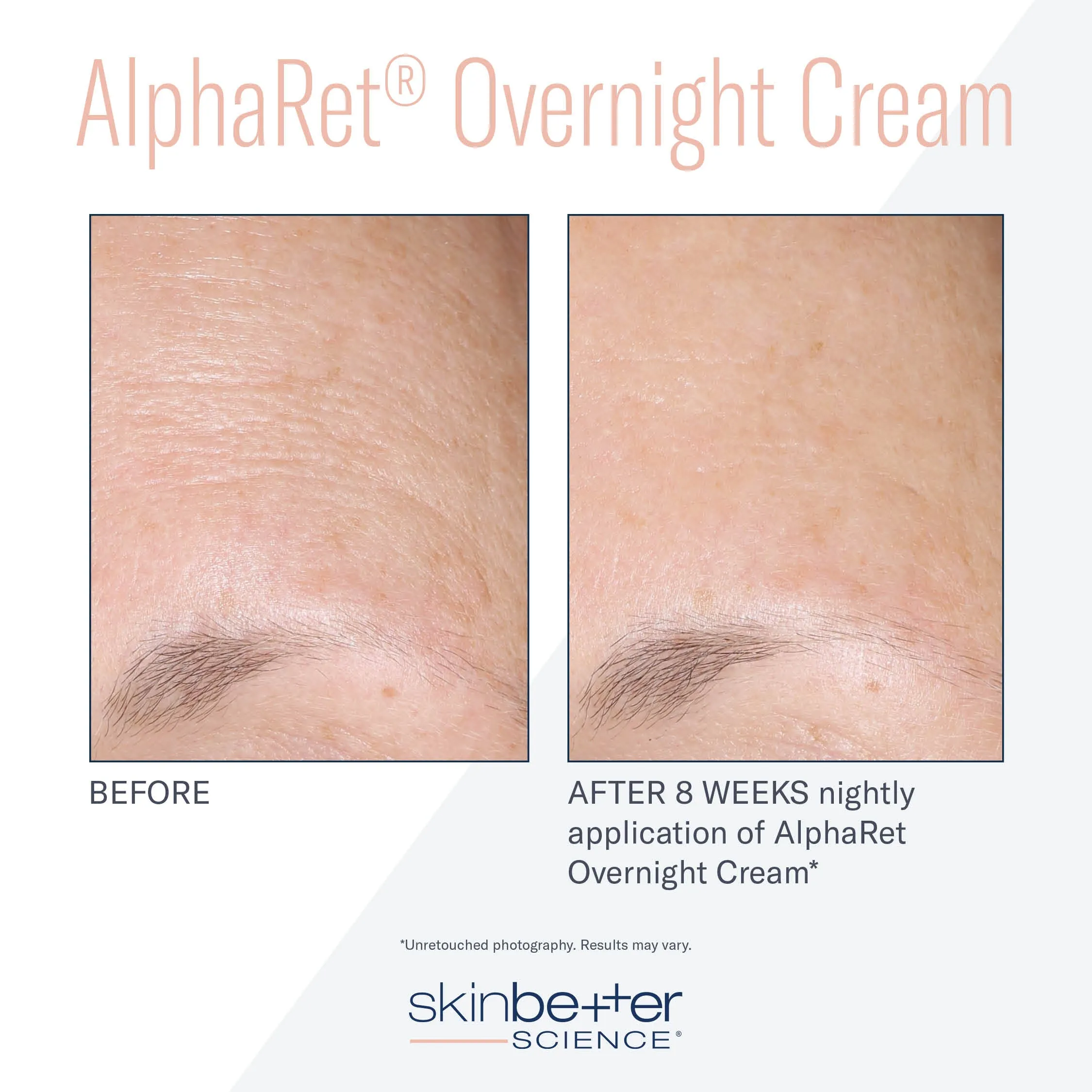 SKIN BETTER SCIENCE - AlphaRet Intensive Overnight Cream