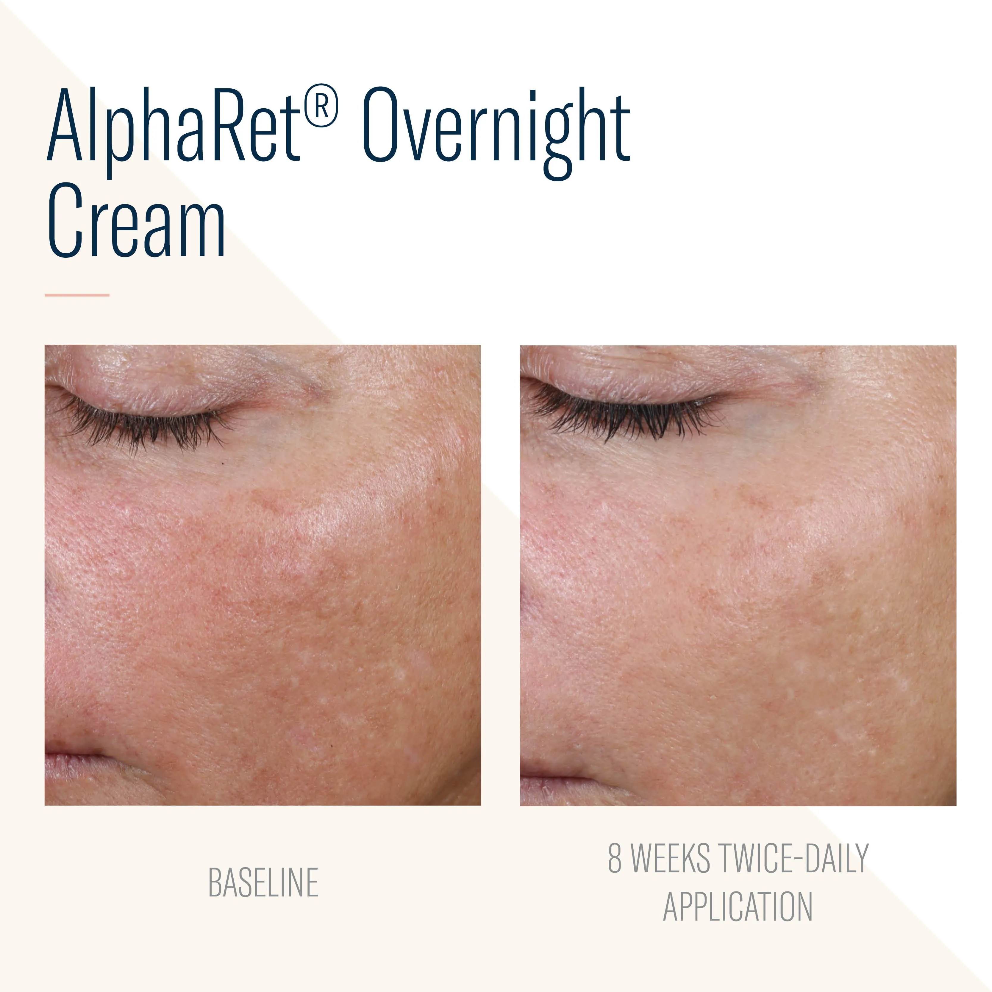 SKIN BETTER SCIENCE - AlphaRet Intensive Overnight Cream